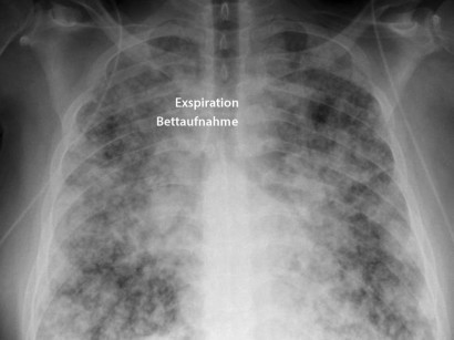 Kasuistiken Aus Der Radiologie Springermedizin De