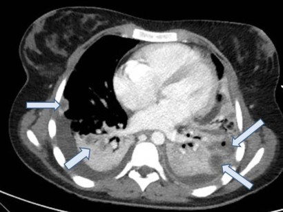 Radiologische Techniken Und Methoden Techniken Und Methoden Springermedizin De