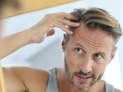 Alopezie Alopezie Springermedizin De