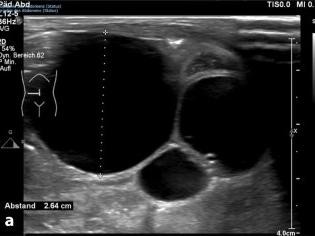 Kasuistiken Aus Der Radiologie Springermedizin De