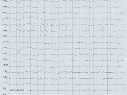 Padiatrische Notfall Und Intensivmedizin Padiatrische Notfall Und Intensivmedizin Springermedizin De
