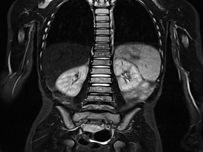 Was bedeutet ein ausrufezeichen auf mrt