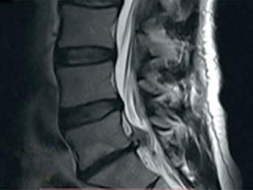 Was bedeutet ein ausrufezeichen auf mrt
