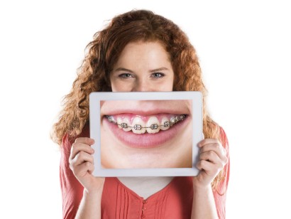 Tandheelkunde | Tandarts en orthodontist schieten bij voorlichting over beugels | mijn-bsl