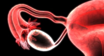 Ovarielles Uberstimulationssyndrom Die Therapie Erfolgt Symptom Und Stadienadaptiert Springermedizin De