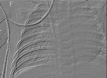 View full size image