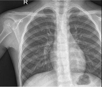 View full size image