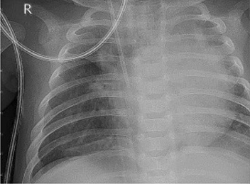 View full size image