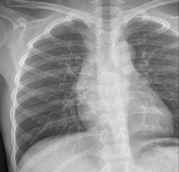 View full size image