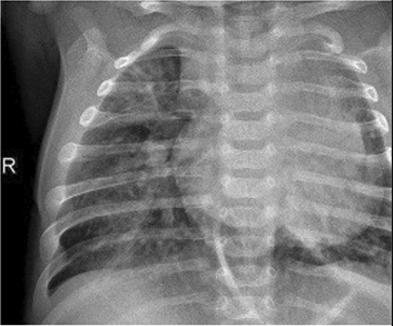 View full size image