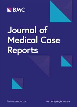 Journal of Medical Case Reports | Home page