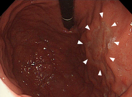 December Featured Article Image