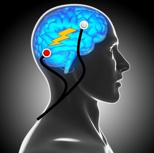 Journal of NeuroEngineering and Rehabilitation | Home page