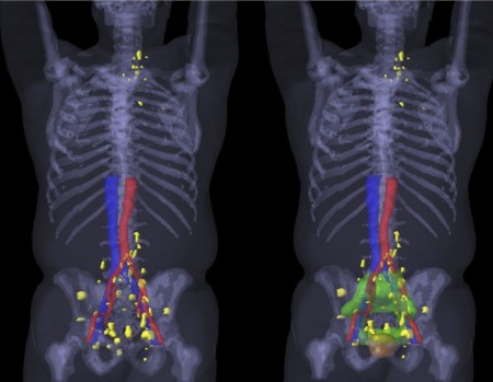 Bmc Cancer Home Page