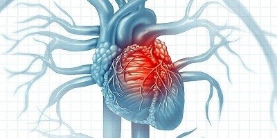 Cardiovascular Diseases