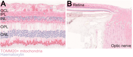 Acta Neuropathologica Communications | Home page