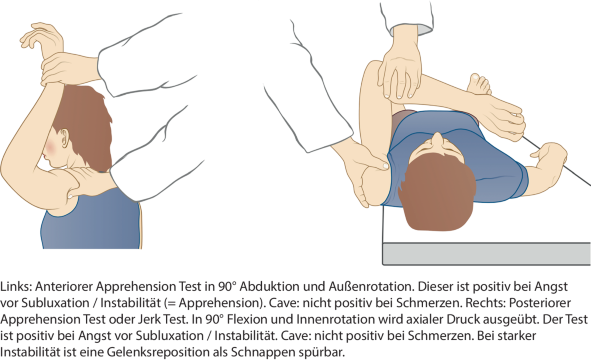 Außenrotation bei 90 Grad Abduktion