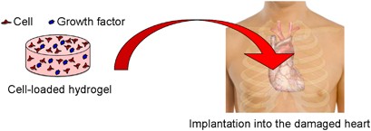 Hydrogels for cardiac tissue engineering