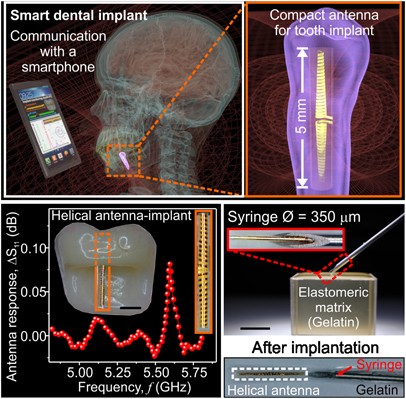 Compact helical antenna for smart implant applications