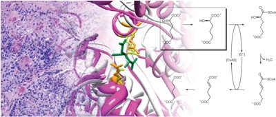 Enzyme redesign guided by cancer-derived <i>IDH1</i> mutations