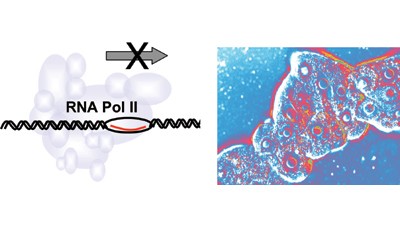 Inhibiting transcription of chromosomal DNA with antigene peptide nucleic acids