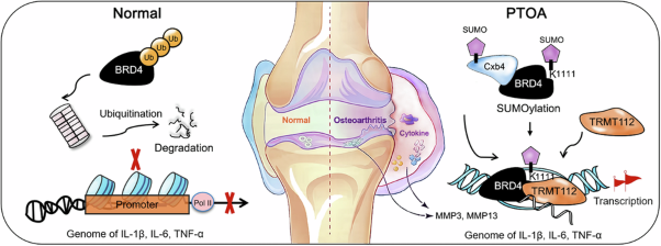 Cbx4 SUMOylates BRD4 to regulate the expression of inflammatory cytokines in post-traumatic osteoarthritis