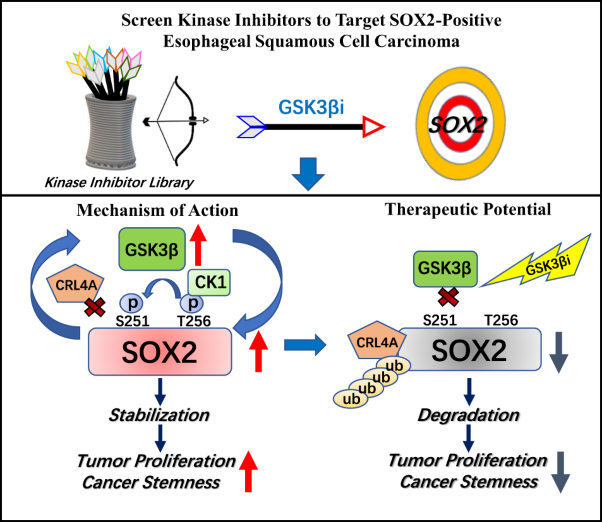GSK3β-driven SOX2 overexpression is a targetable vulnerability in esophageal squamous cell carcinoma
