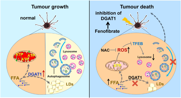Targeting DGAT1 inhibits prostate cancer cells growth by inducing autophagy flux blockage via oxidative stress