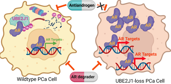 UBE2J1 is the E2 ubiquitin-conjugating enzyme regulating androgen receptor degradation and antiandrogen resistance