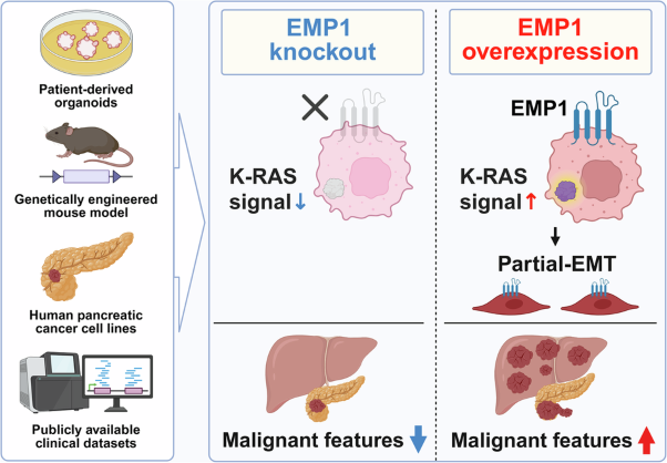 Role of a transmembrane protein, epithelial membrane protein 1, in the pathogenesis of pancreatic ductal adenocarcinoma