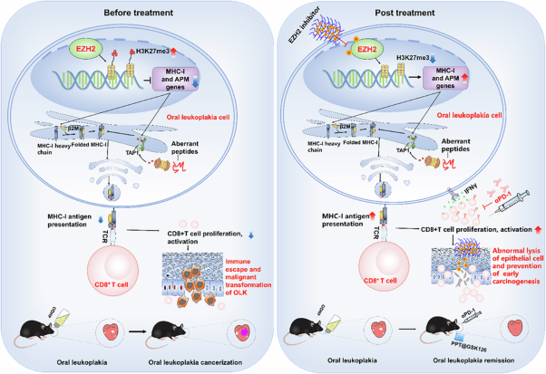 Prevention of cancer initiation by augmenting MHC-I antigen presentation via EZH2 inhibition