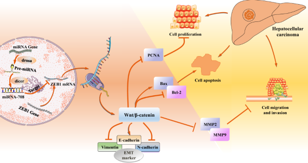 ZEB1 serves an oncogenic role in the tumourigenesis of HCC by promoting cell proliferation, migration, and inhibiting apoptosis via Wnt/β-catenin signaling pathway