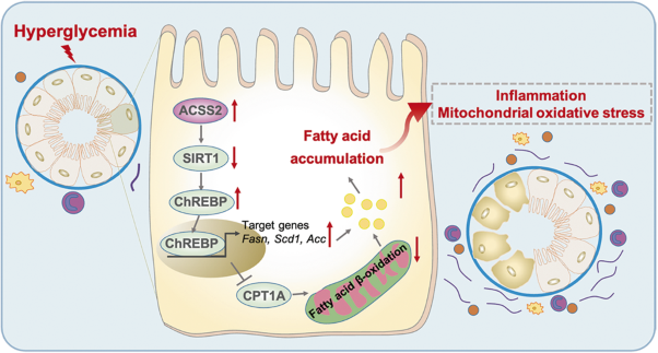 Acetyl-CoA synthetase 2 promotes diabetic renal tubular injury in mice by rewiring fatty acid metabolism through SIRT1/ChREBP pathway