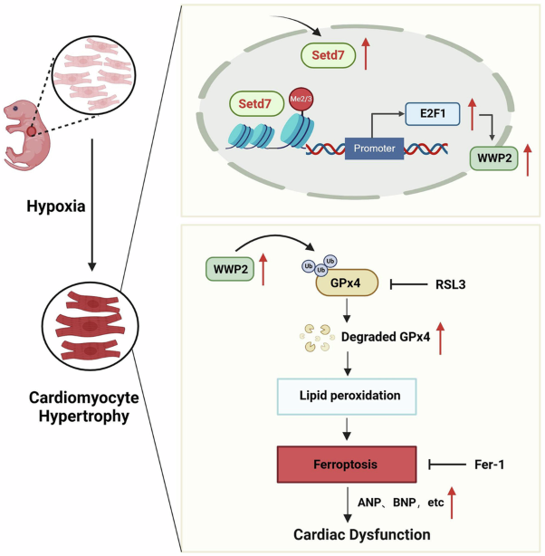 Inhibition of Setd7 protects against cardiomyocyte hypertrophy via inhibiting lipid oxidation