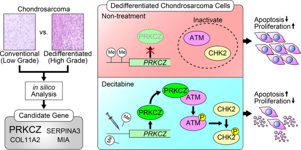 Methylation-mediated silencing of protein kinase C zeta induces apoptosis avoidance through ATM/CHK2 inactivation in dedifferentiated chondrosarcoma