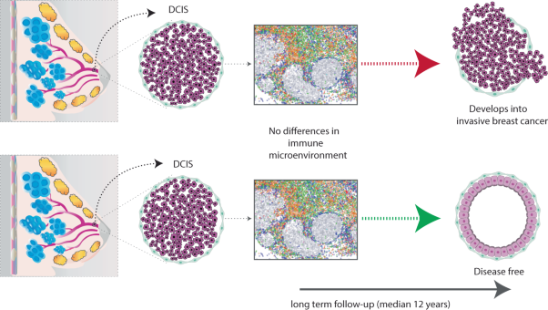 Comprehensive multiplexed immune profiling of the ductal carcinoma in situ immune microenvironment regarding subsequent ipsilateral invasive breast cancer risk