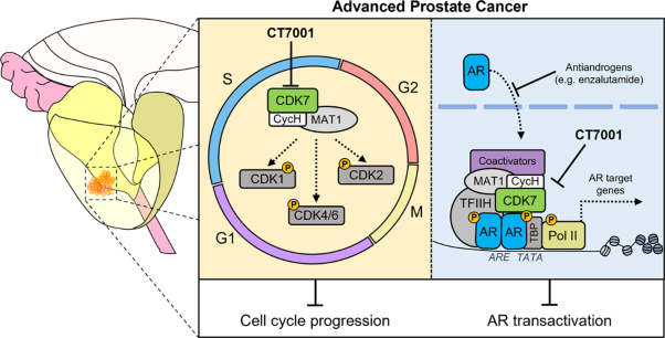 The CDK7 inhibitor CT7001 (Samuraciclib) targets proliferation pathways to inhibit advanced prostate cancer