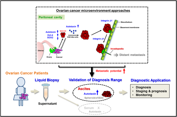 Ascitic autotaxin as a potential prognostic, diagnostic, and therapeutic target for epithelial ovarian cancer