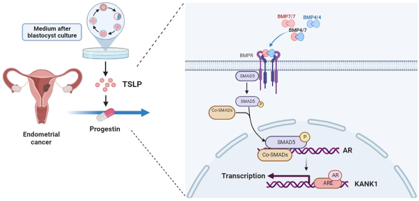 TSLP enhances progestin response in endometrial cancer via androgen receptor signal pathway