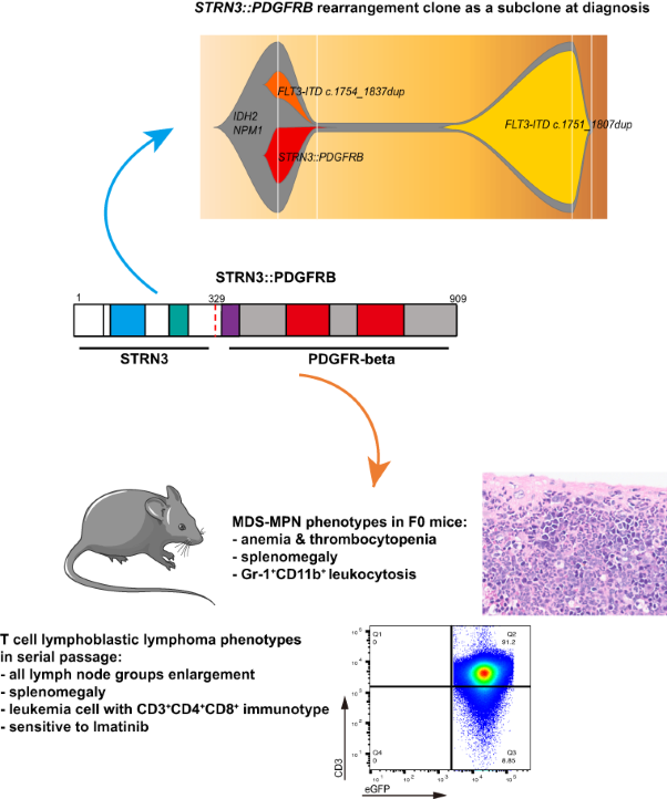 A novel subclonal rearrangement of the <i>STRN3::PDGFRB</i> gene in de novo acute myeloid leukemia with <i>NPM1</i> mutation and its leukemogenic effects