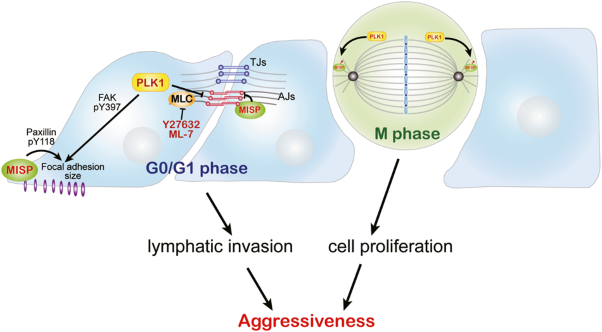 PLK1 and its substrate MISP facilitate intrahepatic cholangiocarcinoma progression by promoting lymphatic invasion and impairing E-cadherin adherens junctions