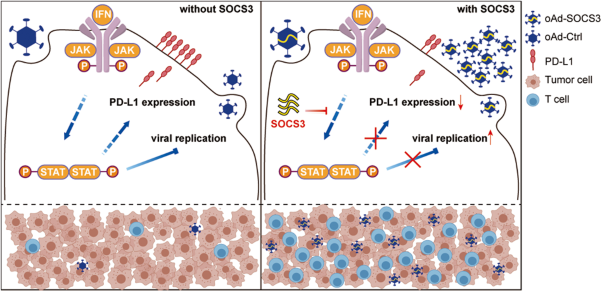 SOCS3 inhibiting JAK-STAT pathway enhances oncolytic adenovirus efficacy by potentiating viral replication and T-cell activation