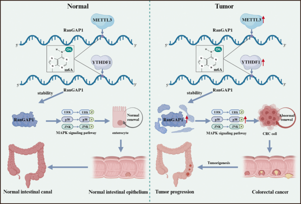 METTL3-mediated RanGAP1 promotes colorectal cancer progression through the MAPK pathway by recruiting YTHDF1