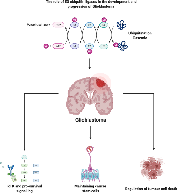 The role of E3 ubiquitin ligases in the development and progression of glioblastoma