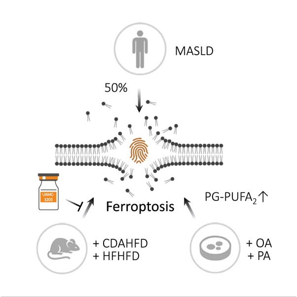 Ferroptosis is a targetable detrimental factor in metabolic dysfunction-associated steatotic liver disease