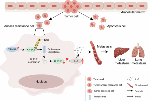 TRIM32 promotes anoikis resistance and metastasis in NSCLC by degrading CHEK2 to enhance IL-6 secretion