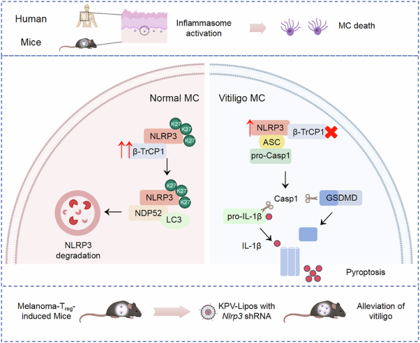 NLRP3 autophagic degradation disruption in melanocytes contributes to vitiligo development
