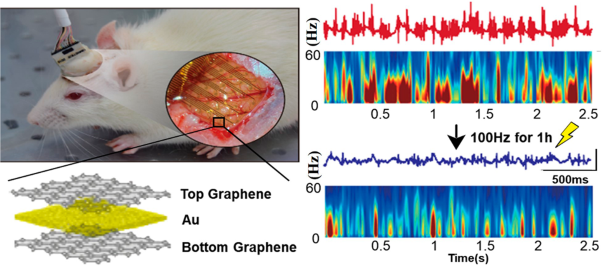 Hybrid graphene electrode for the diagnosis and treatment of epilepsy in free-moving animal models