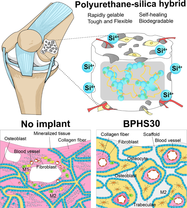 Tough and biodegradable polyurethane-silica hybrids with a rapid sol-gel transition for bone repair