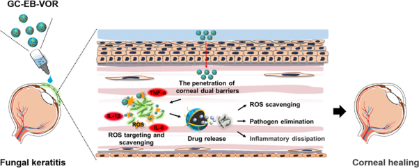 Development of nanodrug-based eye drops with good penetration properties and ROS responsiveness for controllable release to treat fungal keratitis